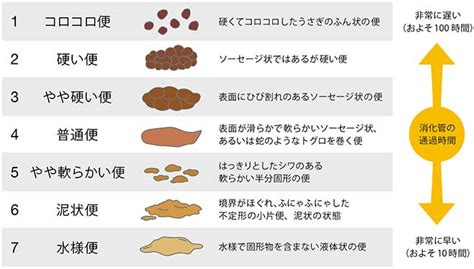 水便原因|消化器内科専門医が解説する下痢症〜下痢の定義、原因、症状と。